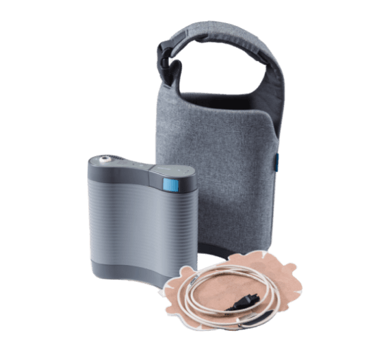 Optune GIO device displayed alongside a person, highlighting innovative cancer treatment technology