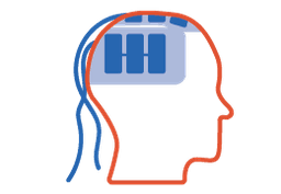 Optune use instructions infographic showing step-by-step guide with medical equipment for brain tumor treatment
